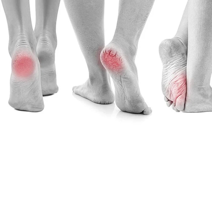 Electric Automatic Foot Pedicure Grinder & Callus Remover - Dead Skin Remover - Electric Foot Dead Skin Callus Remover