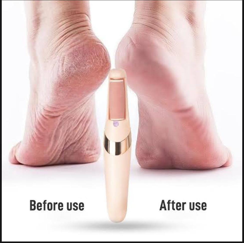 Electric Pedi Callus Remover for Feet | Foot Scrubber for Dry Hard and Dead Skin - Rechargeable Pedicure Tool - Electronic Foot Filer Callus Remover